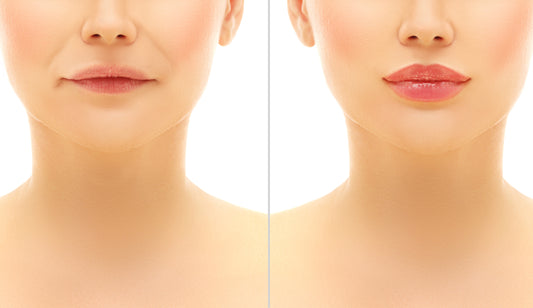 Fillers Utbildning  Advanced